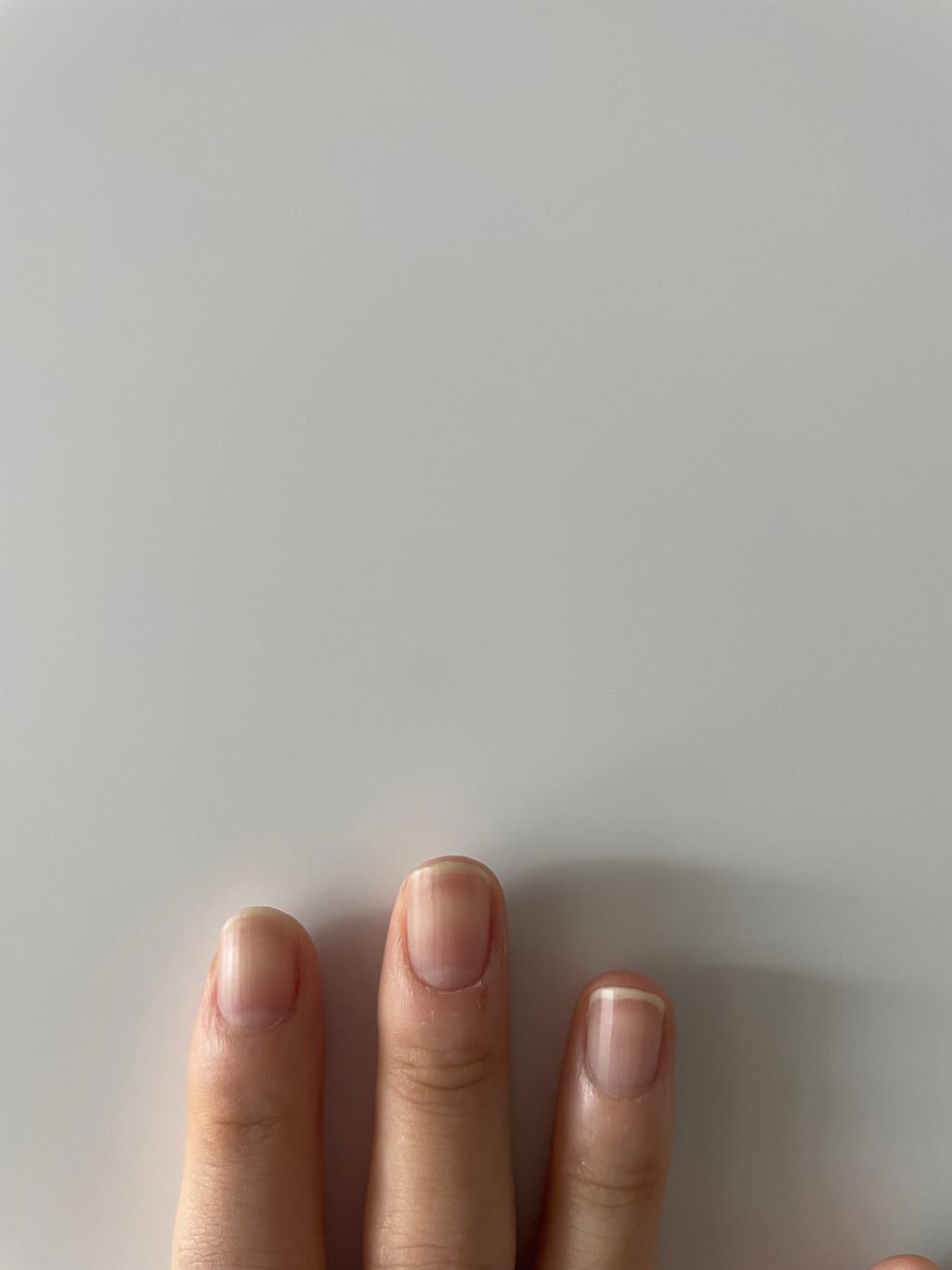 2번 째 사진