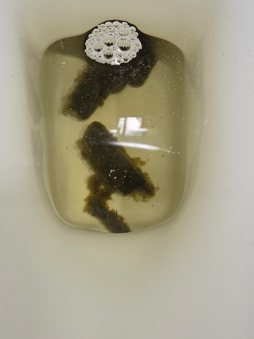 2번 째 사진