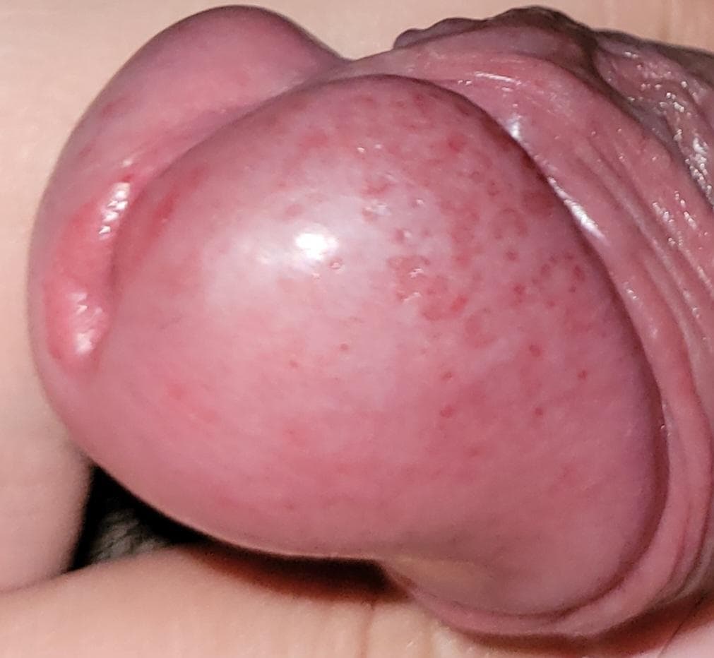2번 째 사진