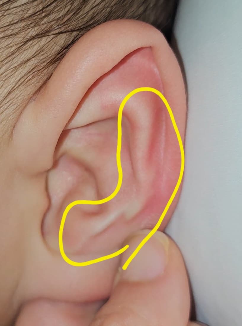 2번 째 사진