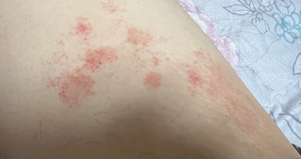 2번 째 사진