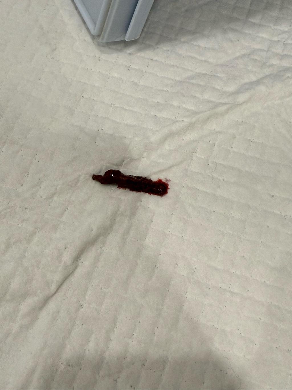 3번 째 사진