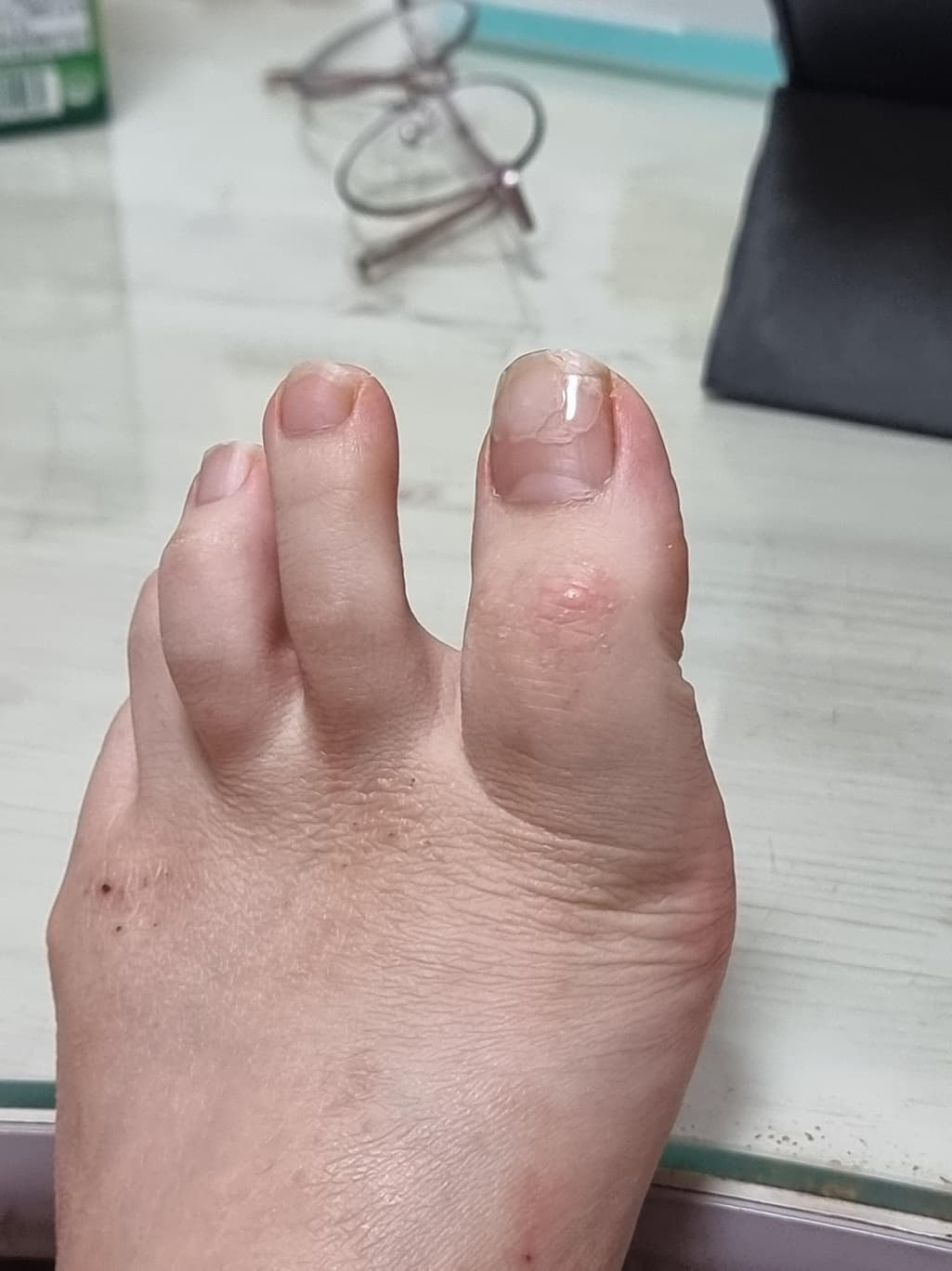 1번 째 사진