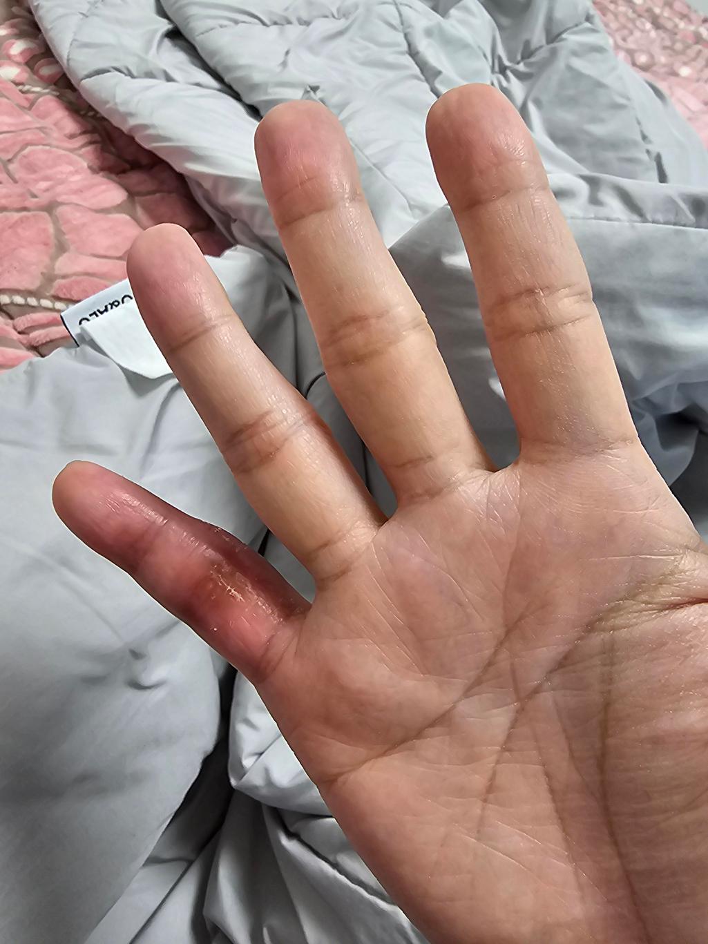 1번 째 사진