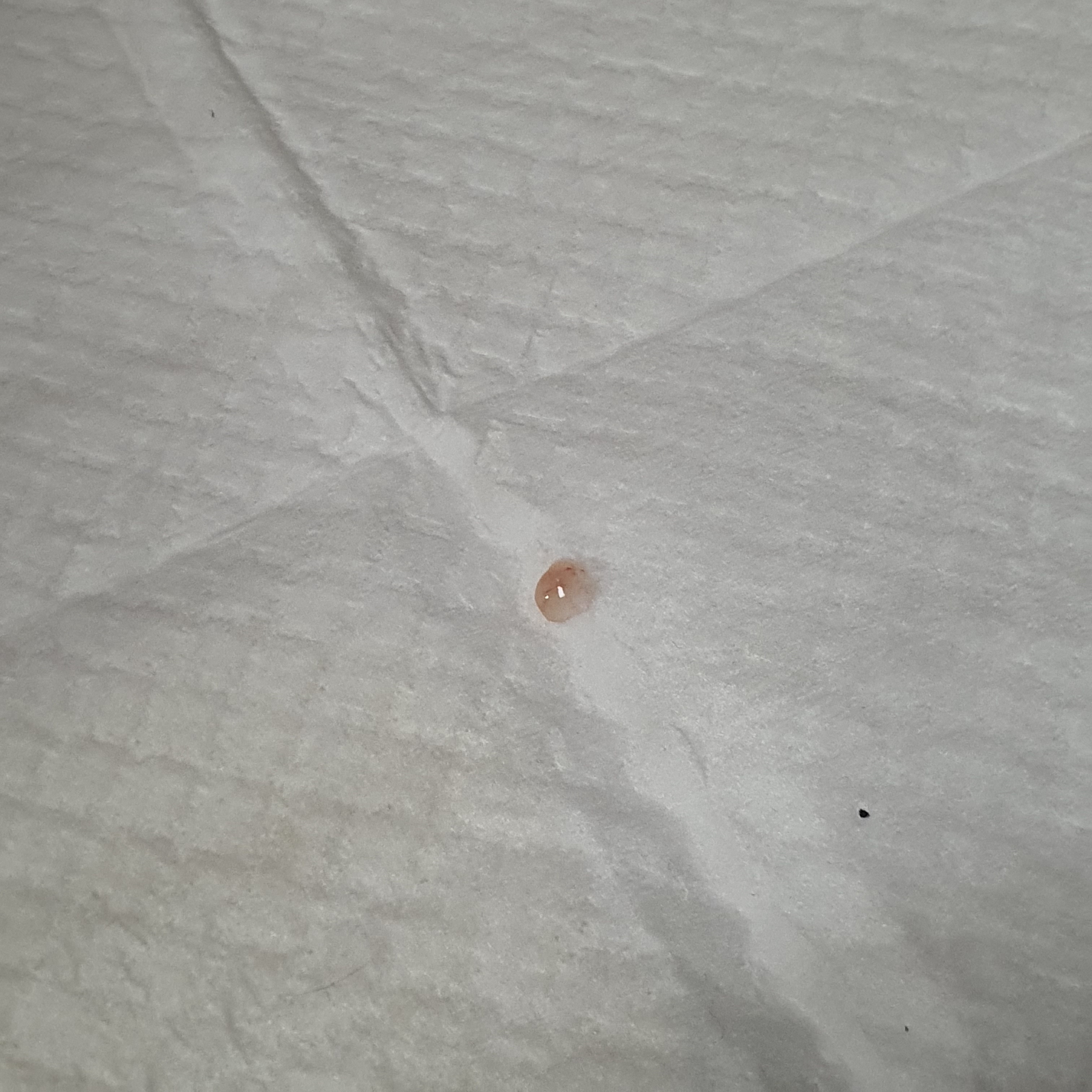 2번 째 사진