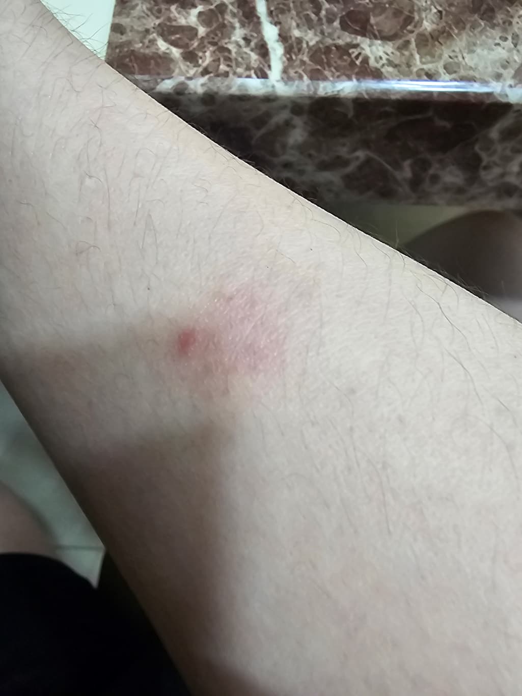 2번 째 사진