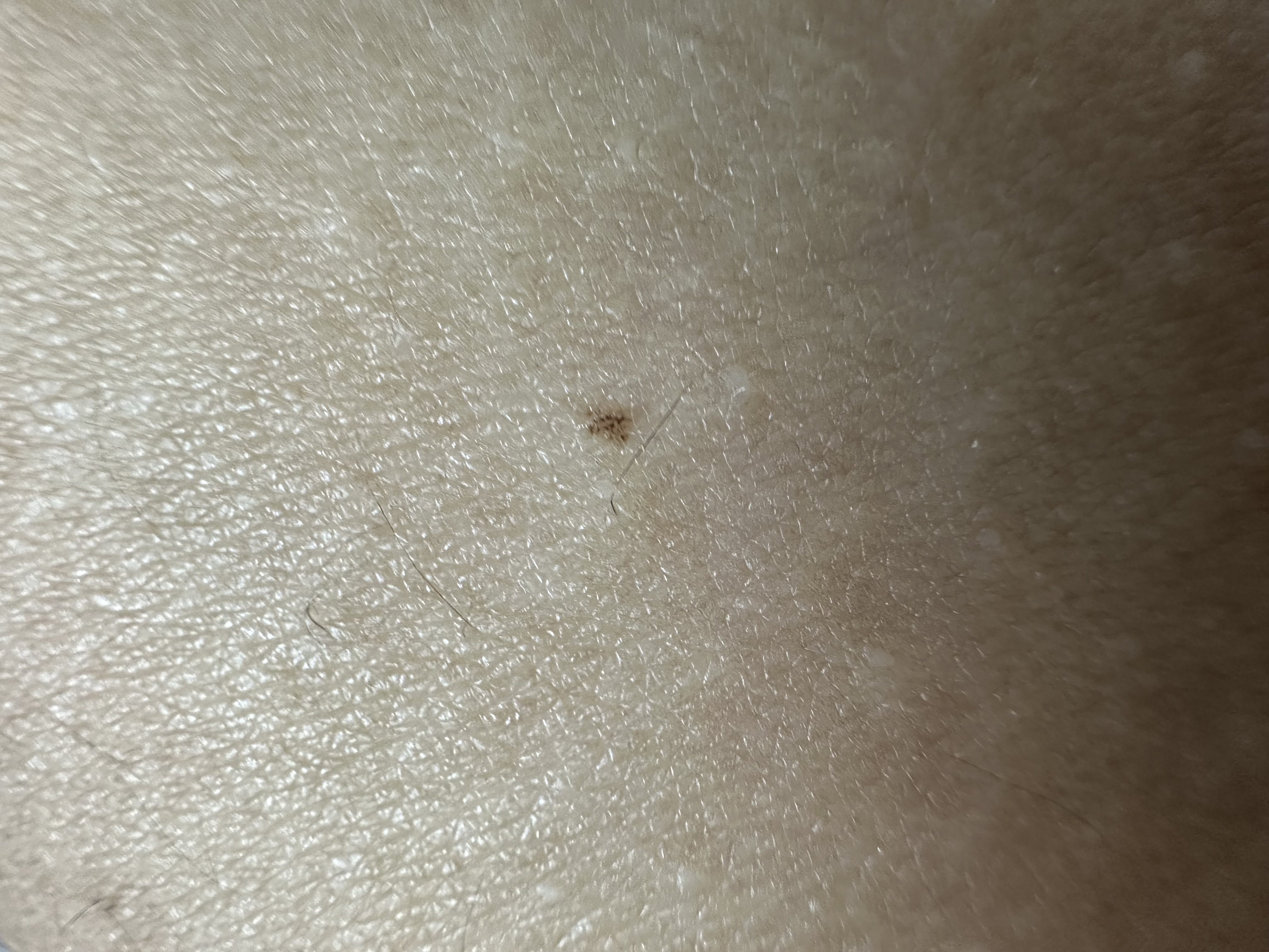 2번 째 사진