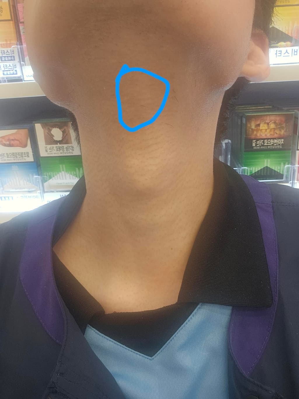 1번 째 사진