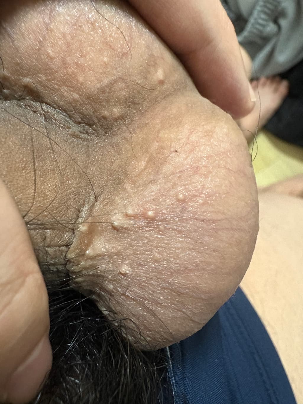 2번 째 사진