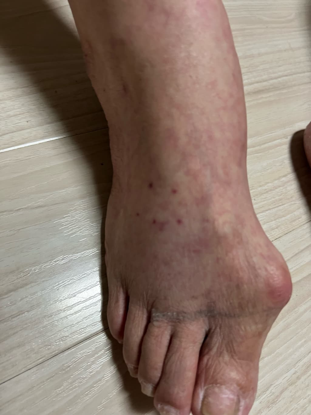 3번 째 사진