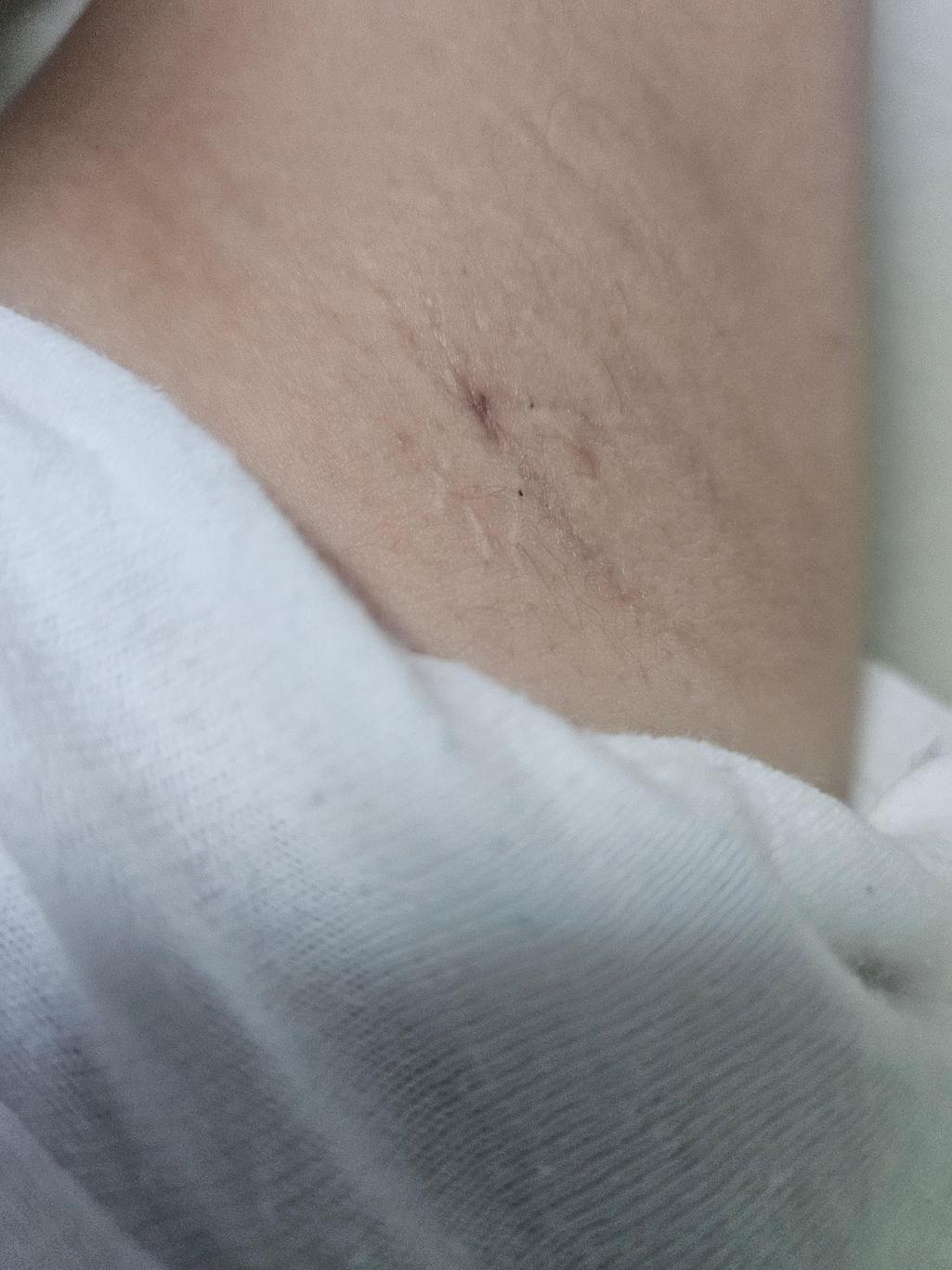 2번 째 사진