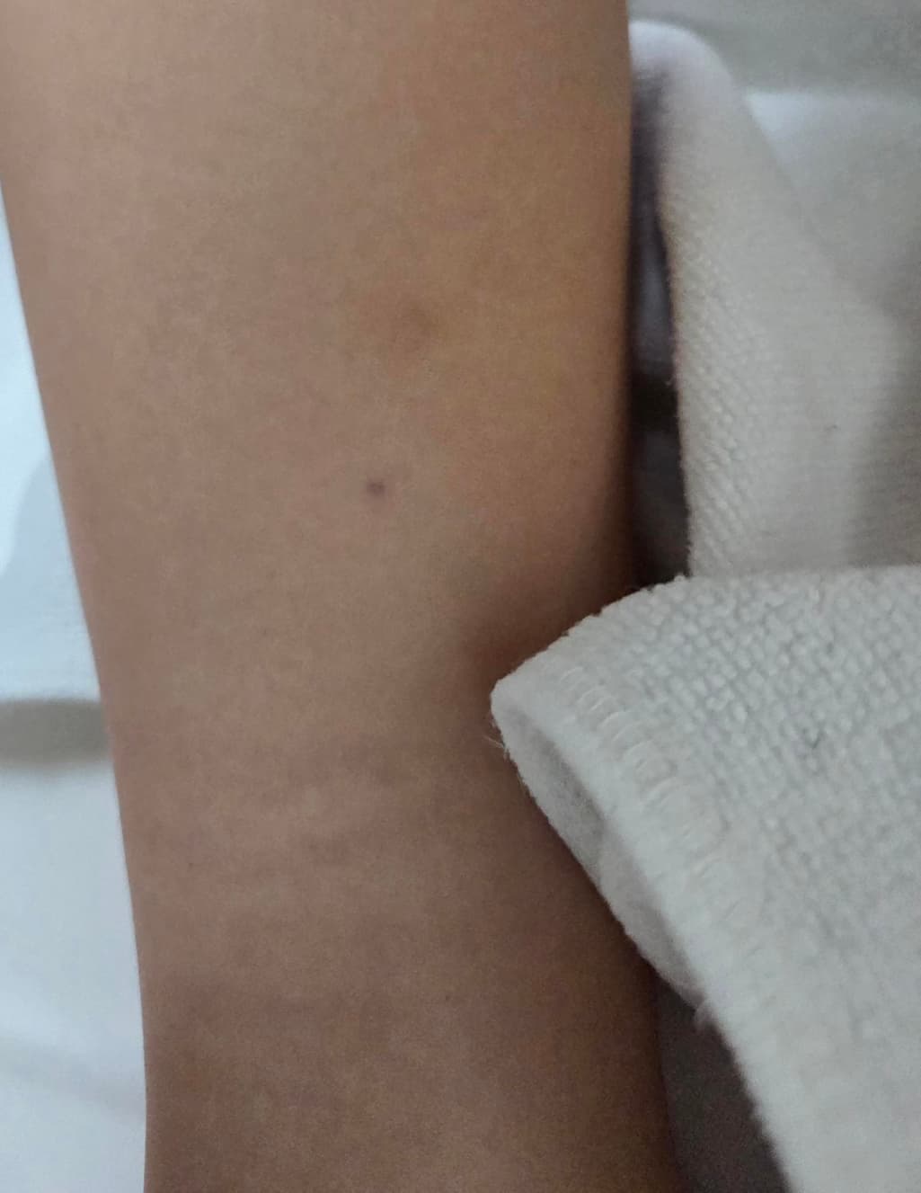 2번 째 사진