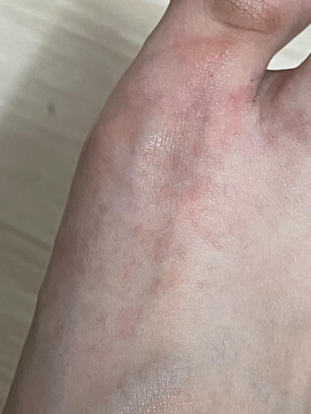 2번 째 사진