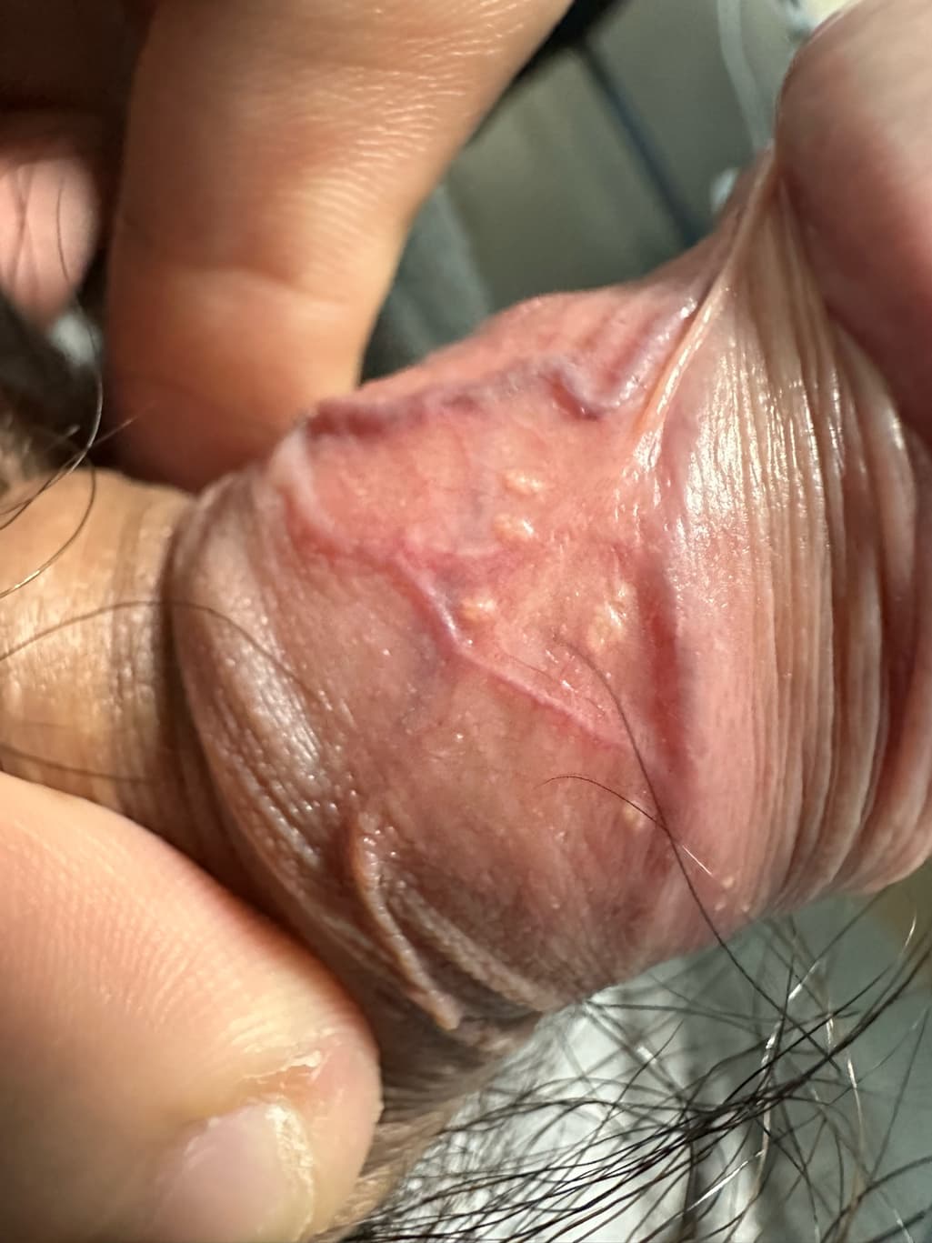 2번 째 사진