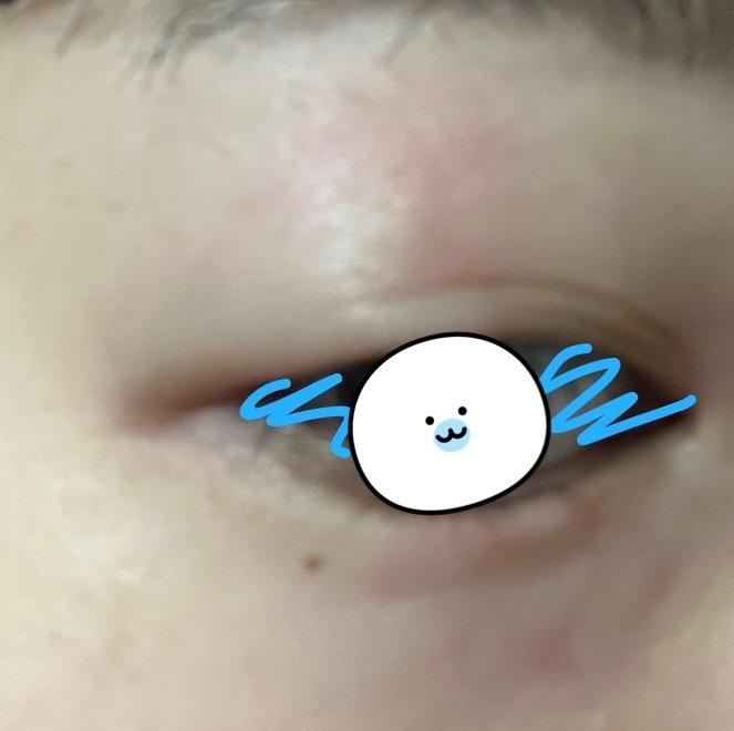 2번 째 사진