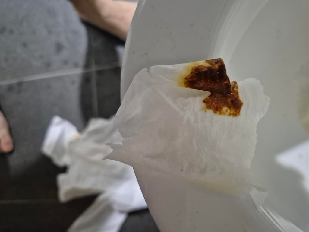 2번 째 사진