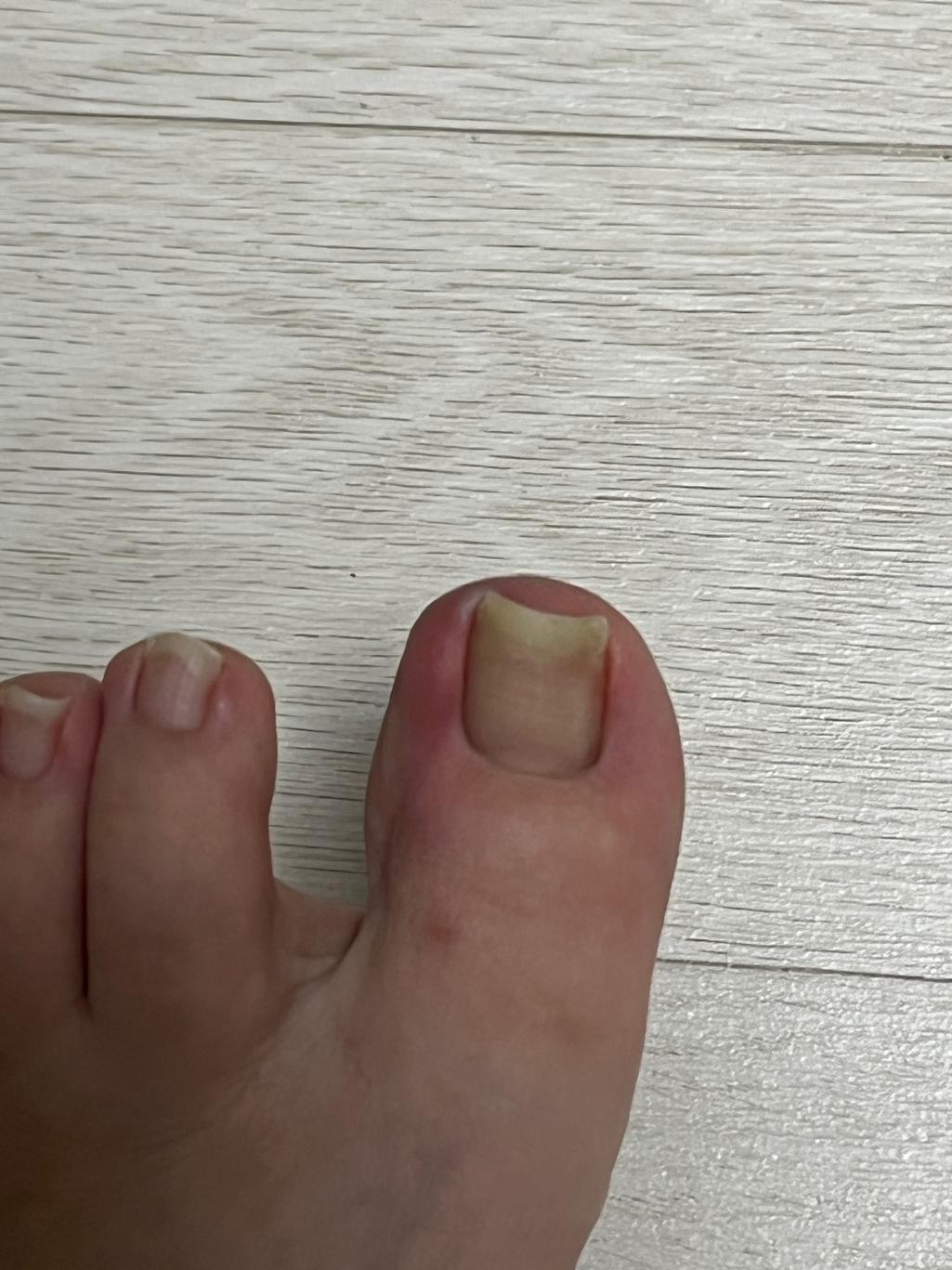 2번 째 사진