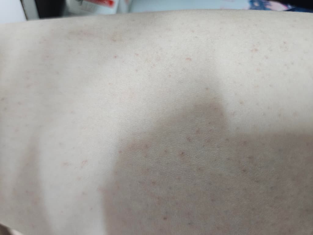 2번 째 사진