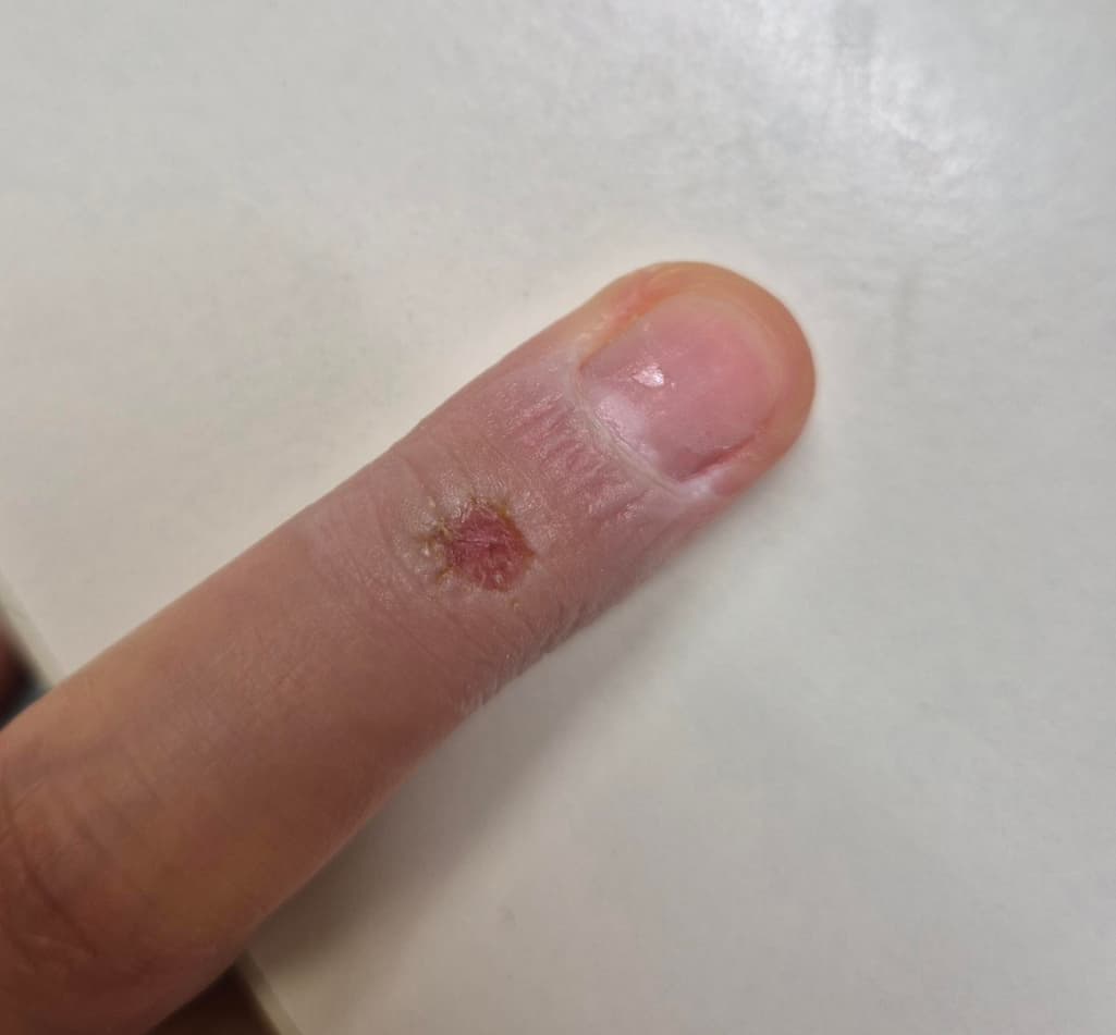 2번 째 사진