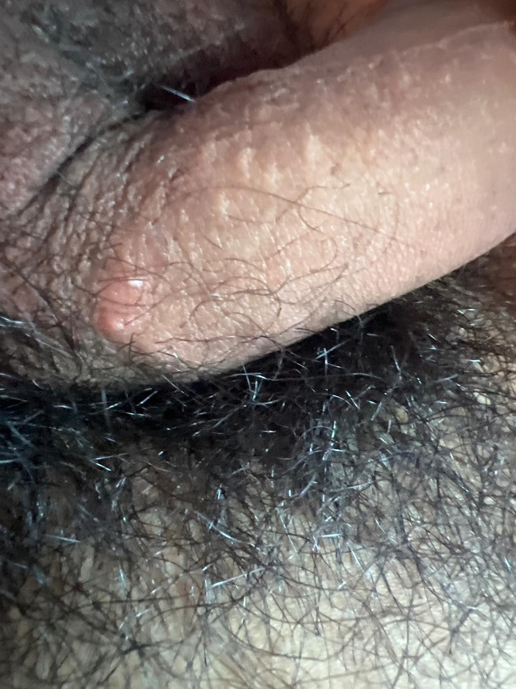 2번 째 사진