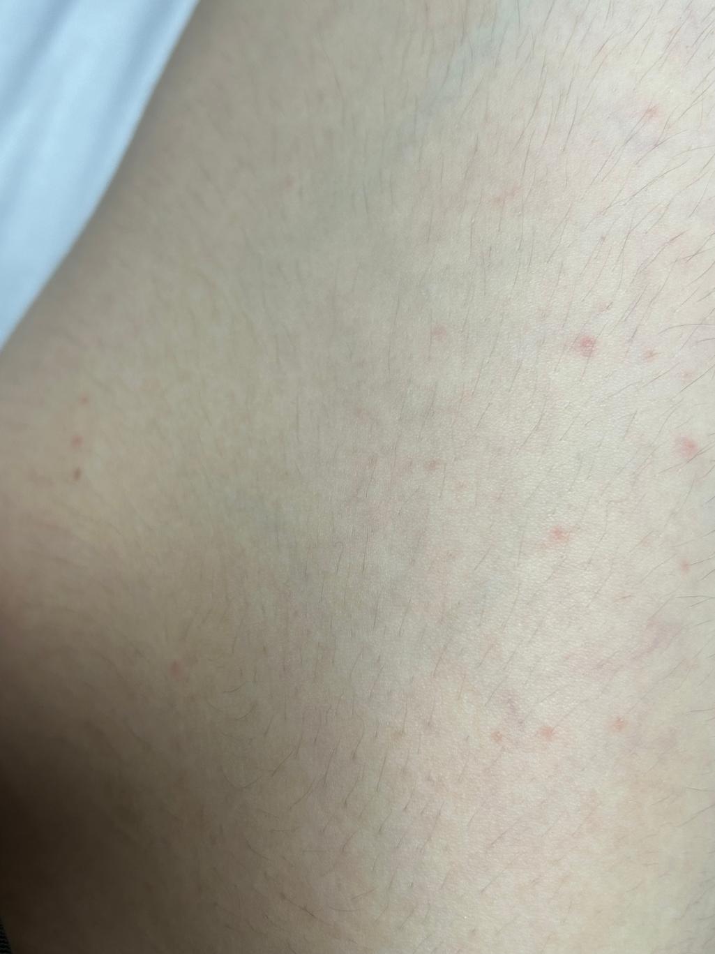 2번 째 사진