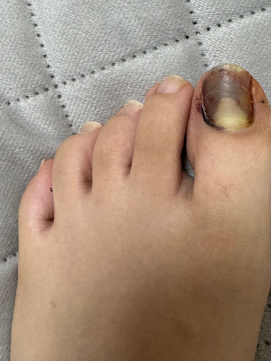 4번 째 사진