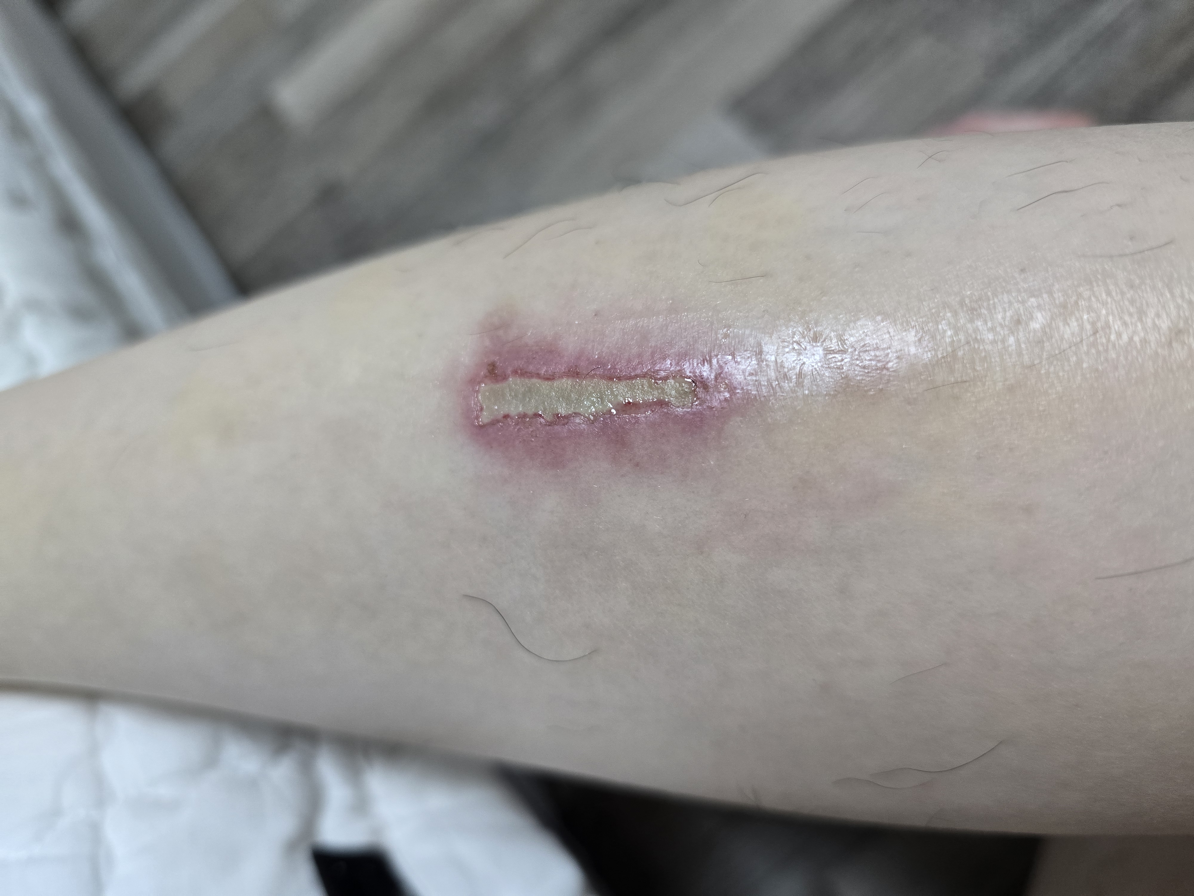 2번 째 사진