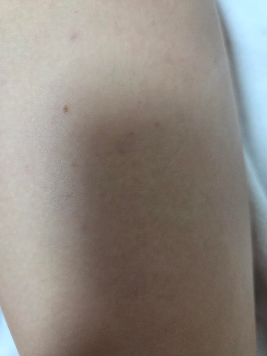 3번 째 사진