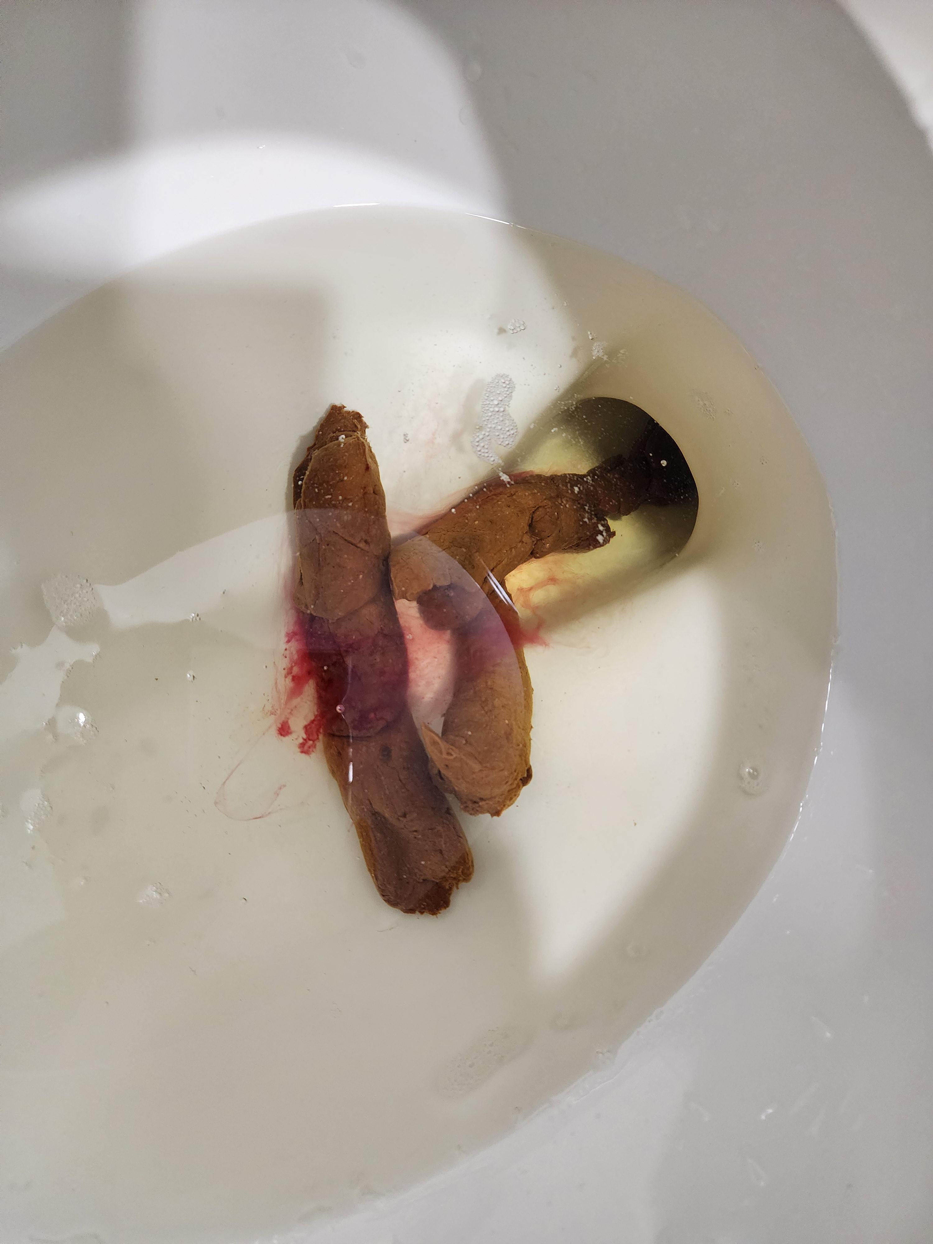2번 째 사진