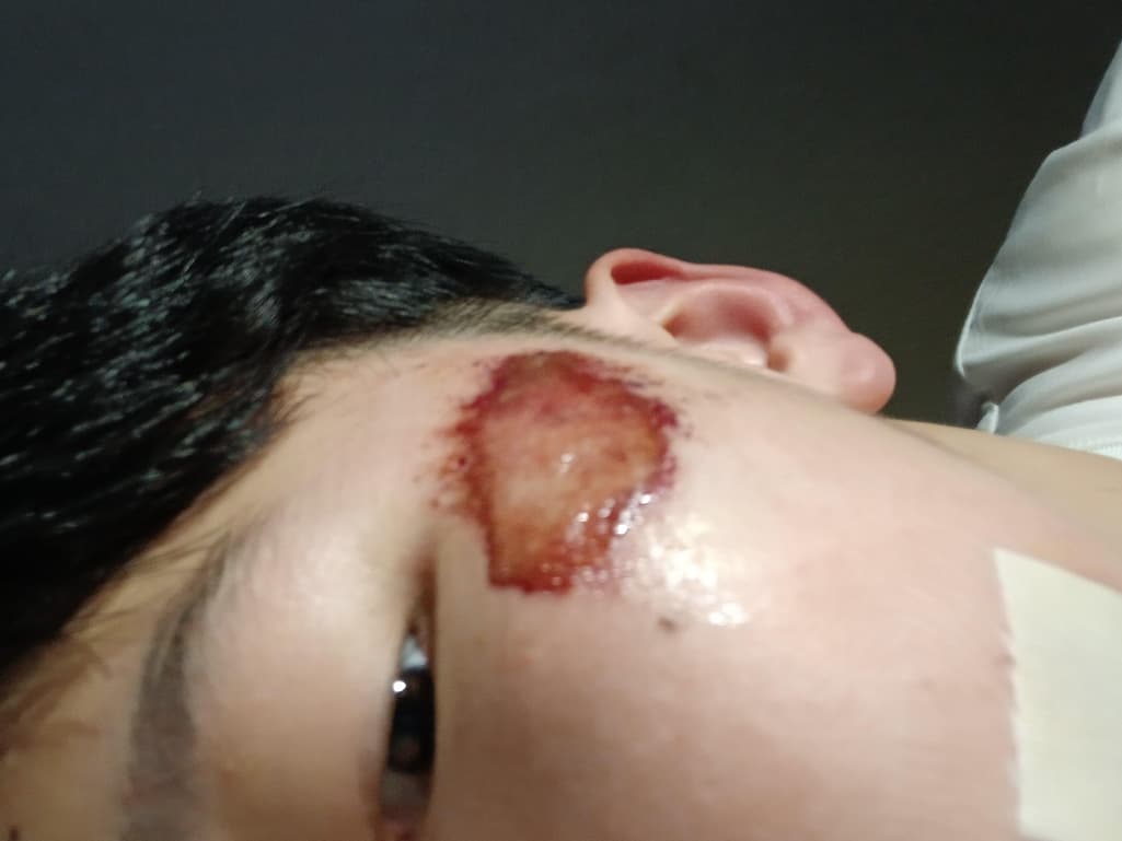 1번 째 사진