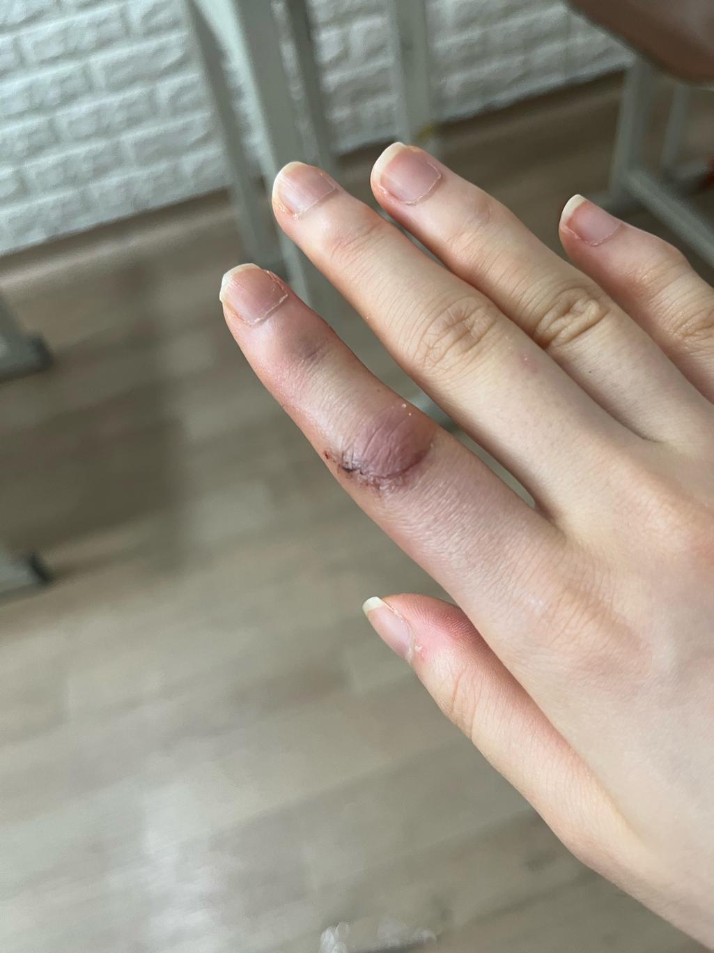 1번 째 사진