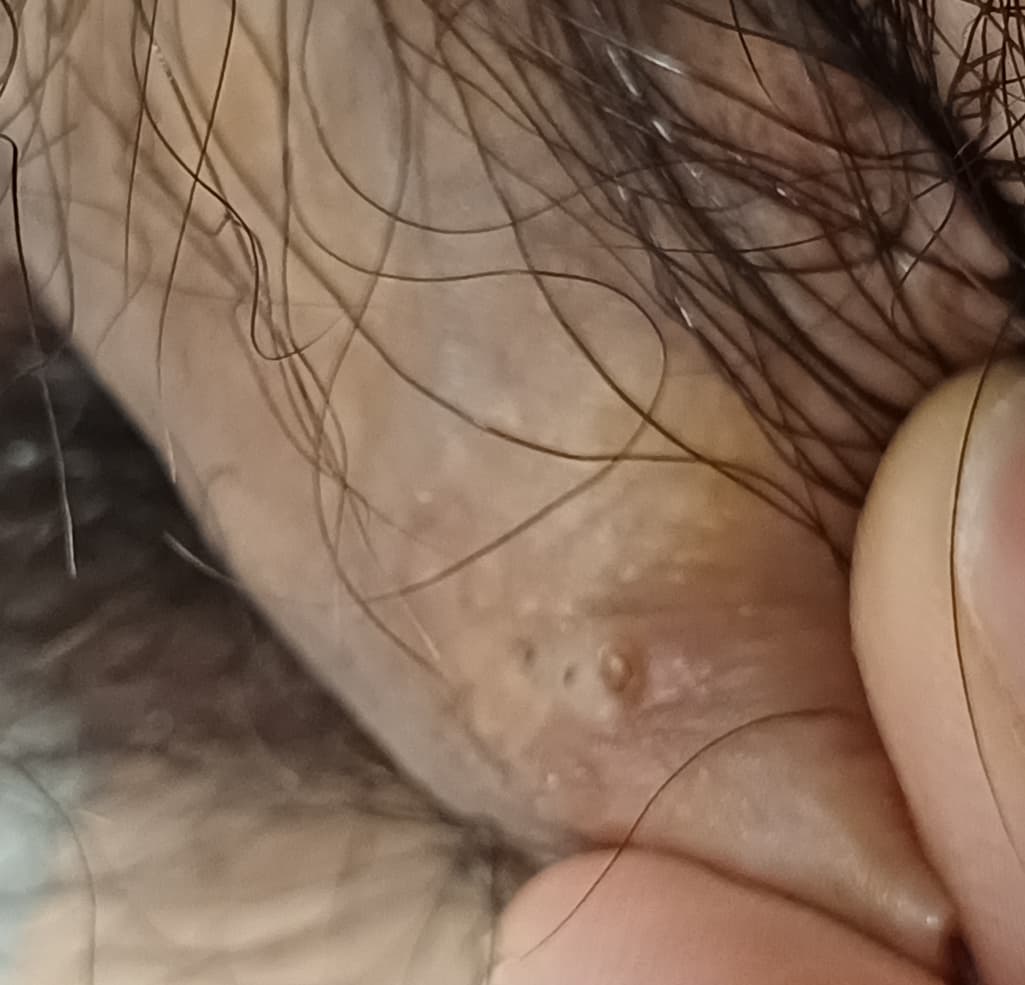 2번 째 사진