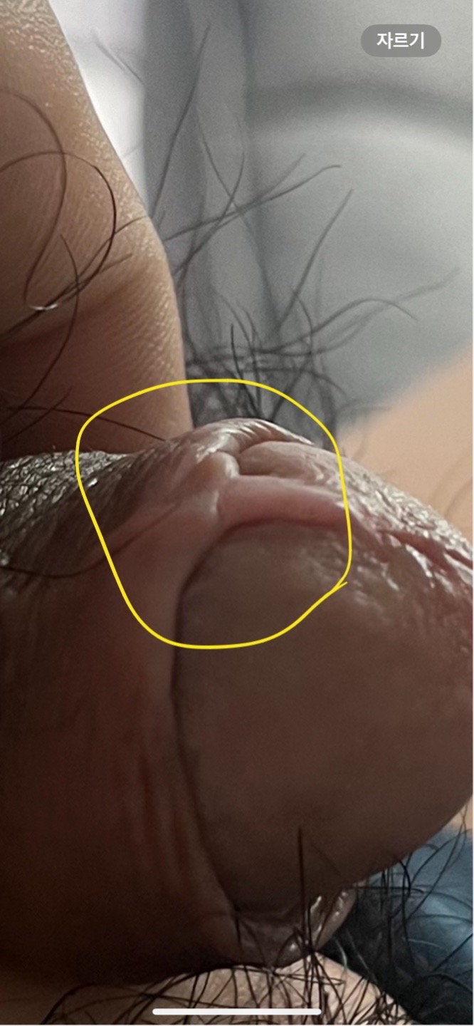 3번 째 사진