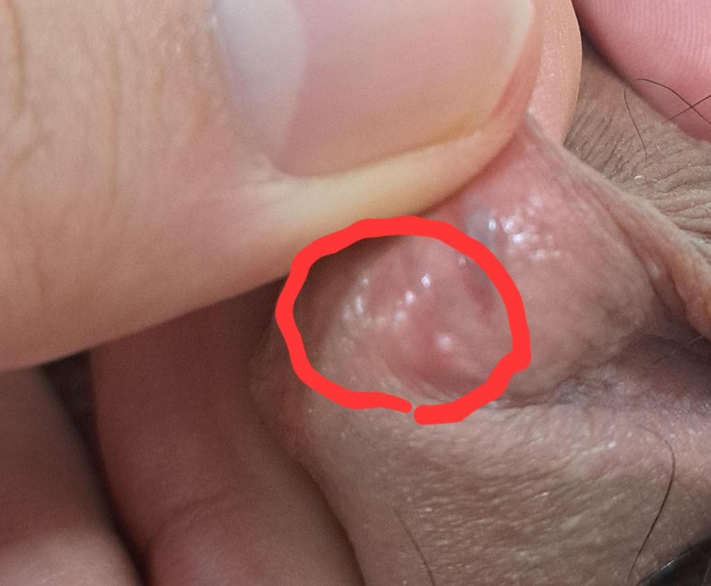 2번 째 사진