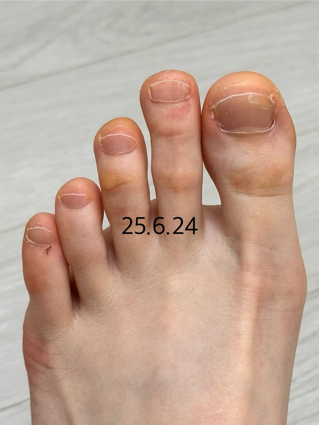 8번 째 사진