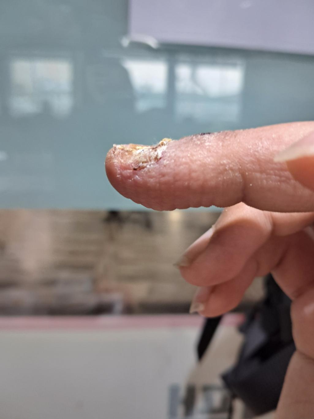 2번 째 사진