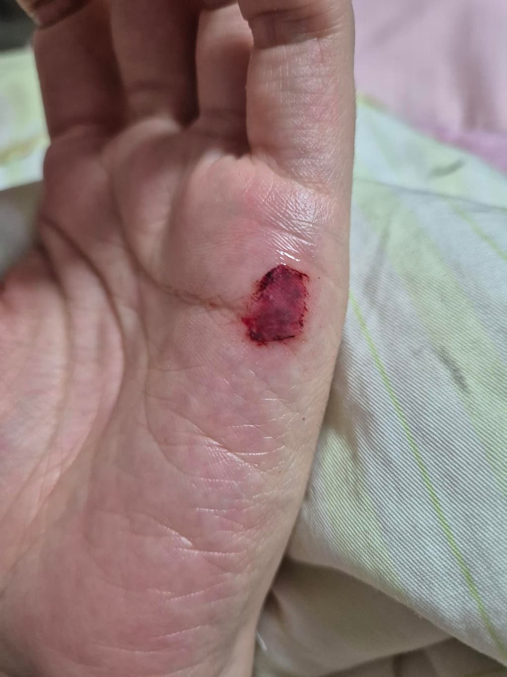 2번 째 사진