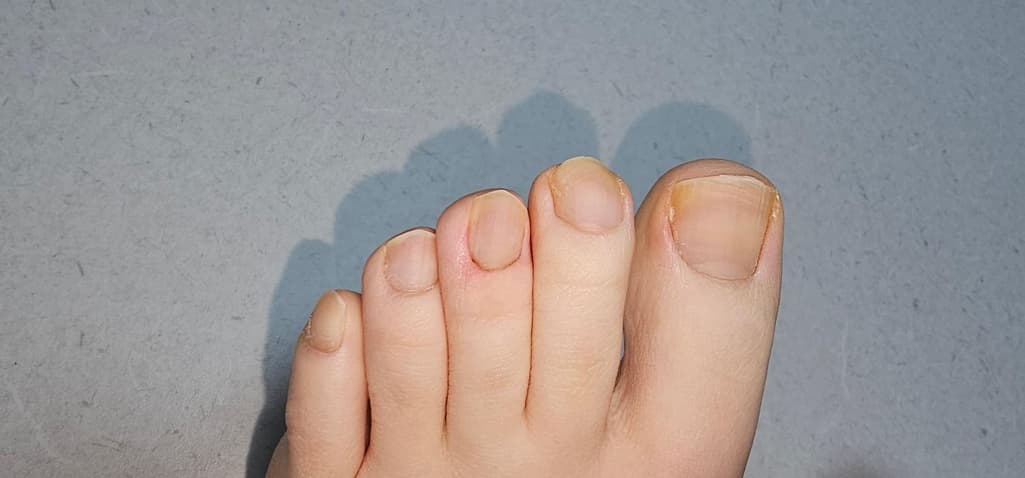 2번 째 사진