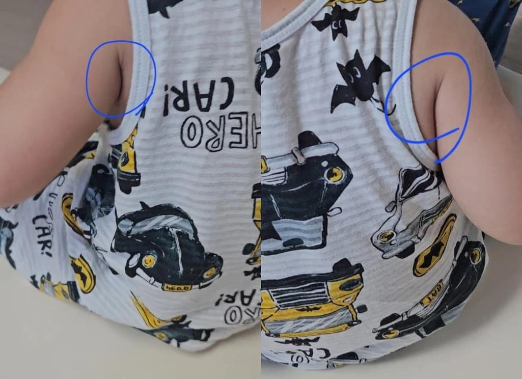 3번 째 사진