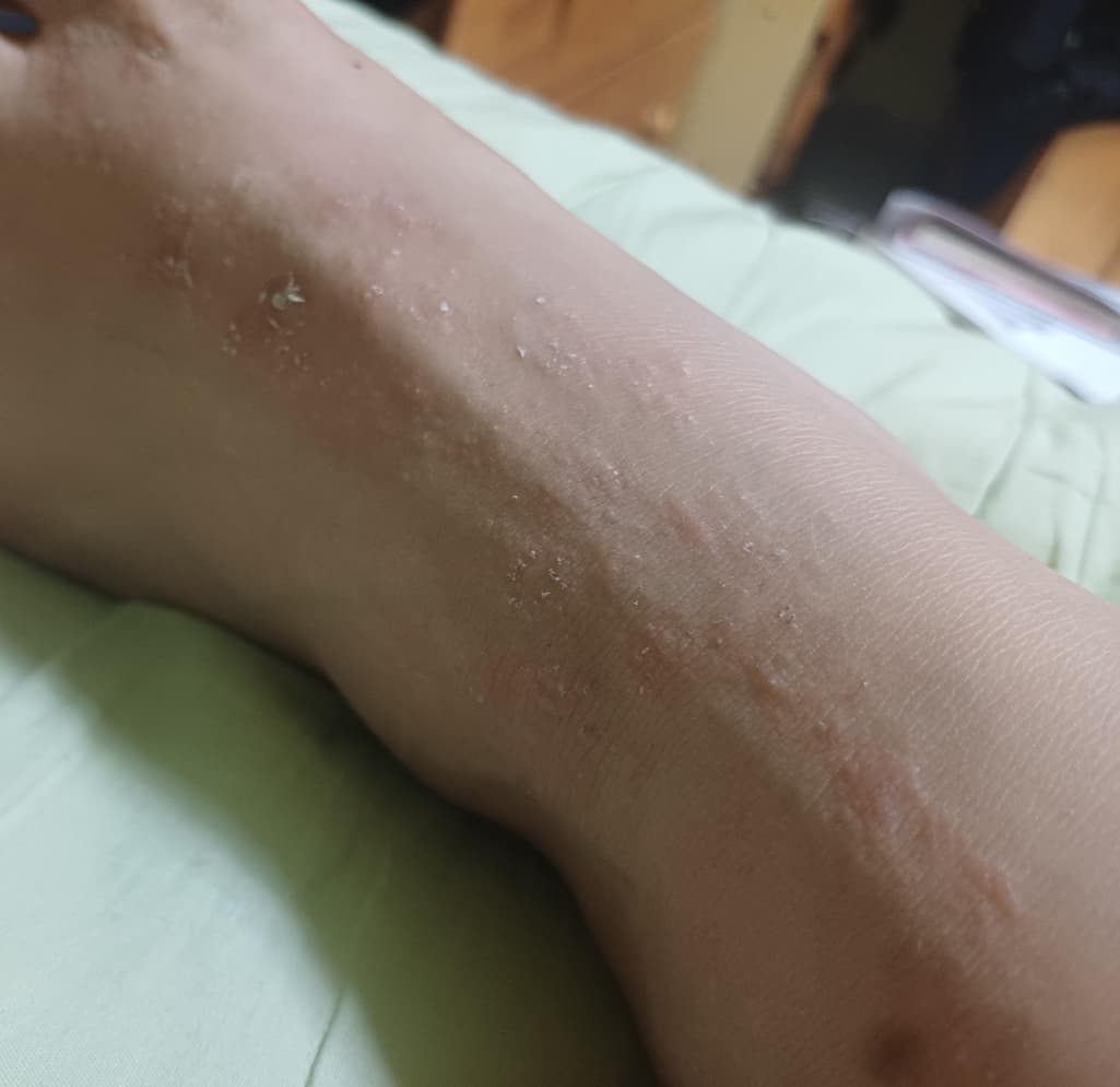 2번 째 사진