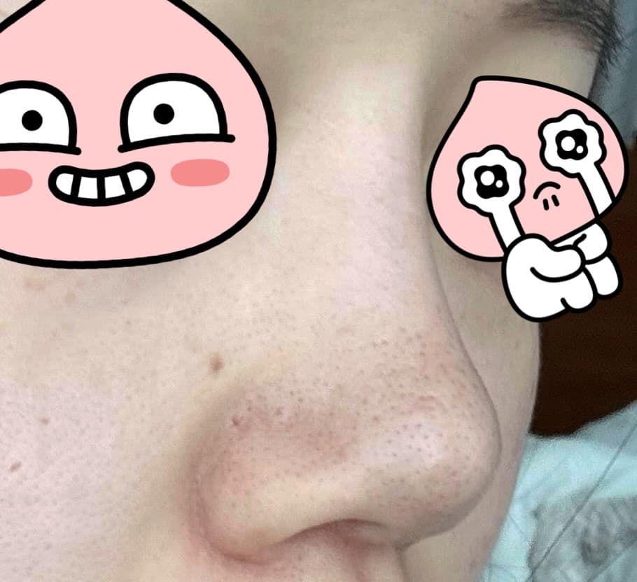 2번 째 사진