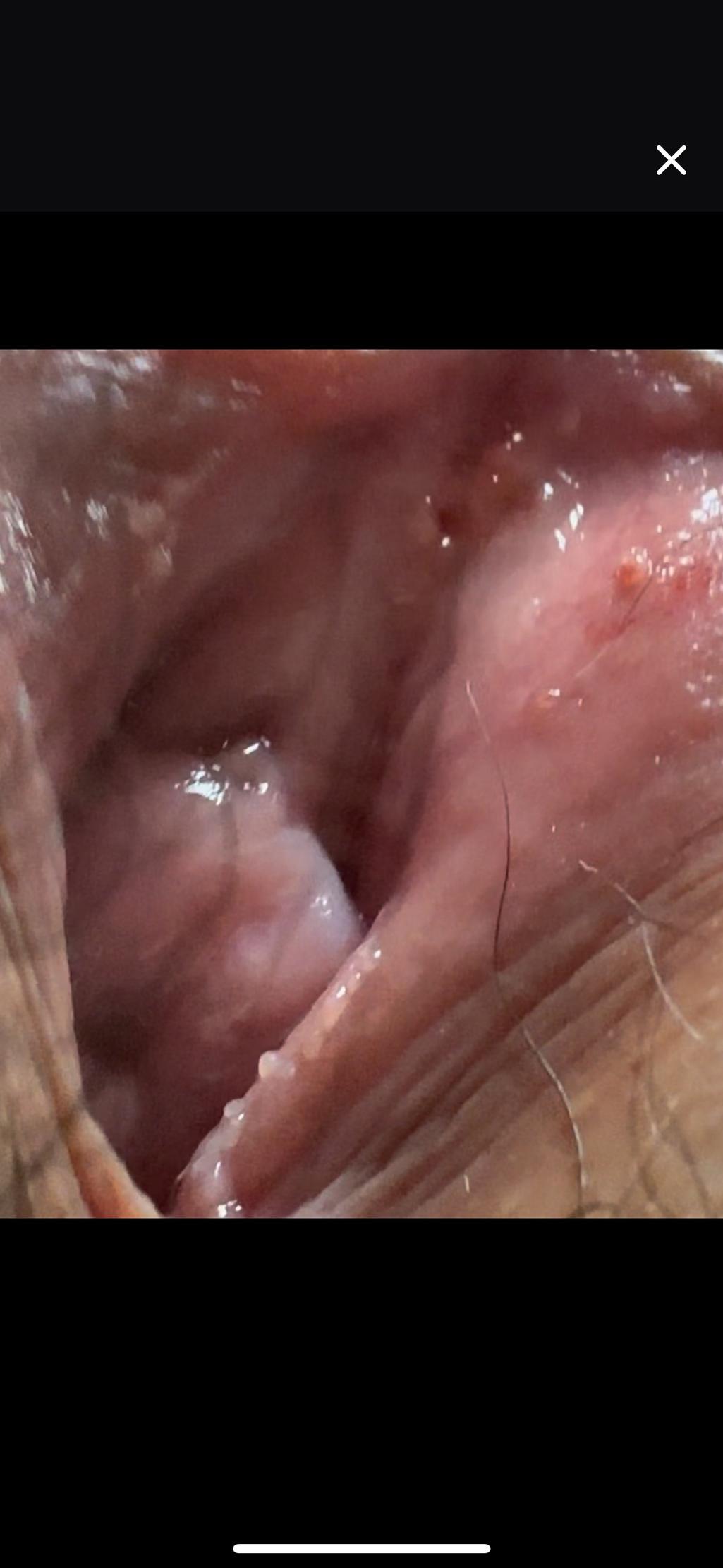 2번 째 사진