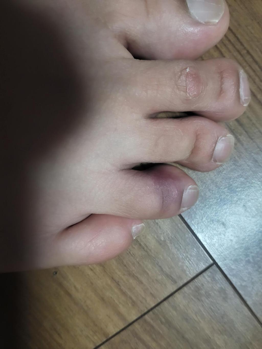 2번 째 사진