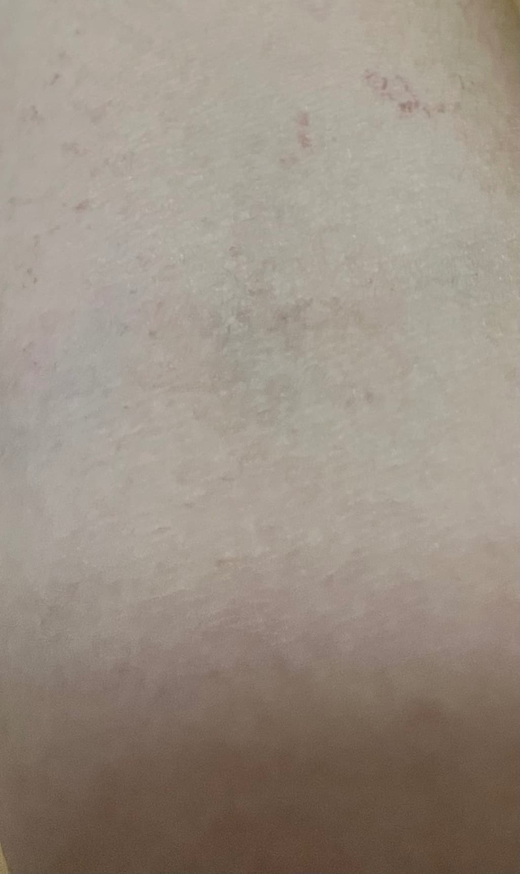2번 째 사진