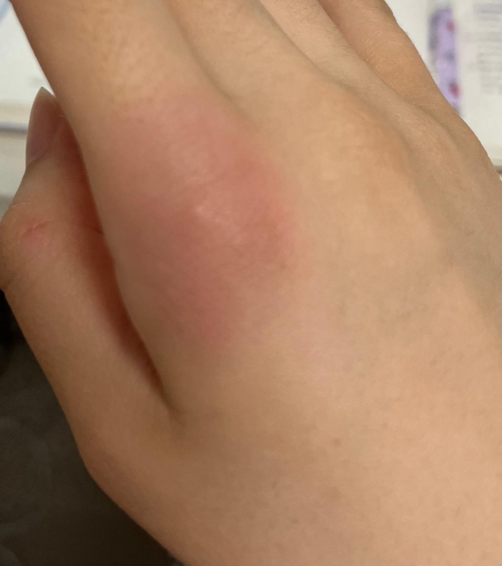 2번 째 사진
