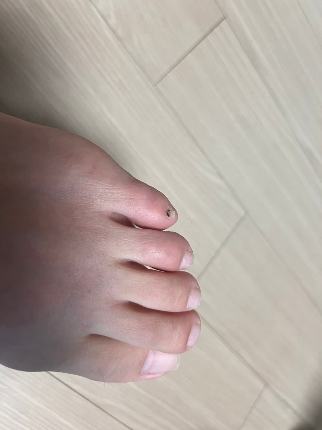 2번 째 사진