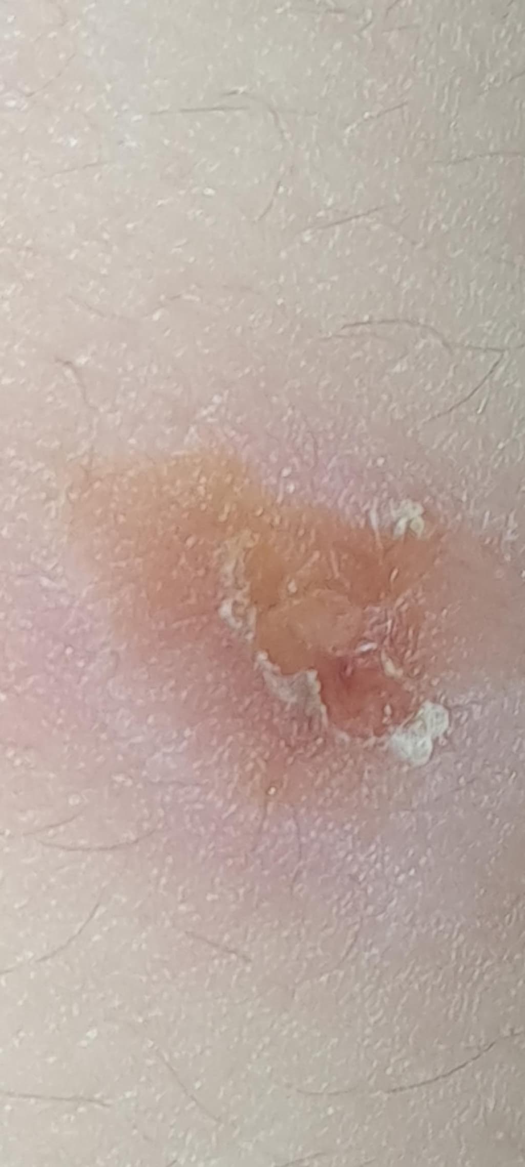 4번 째 사진