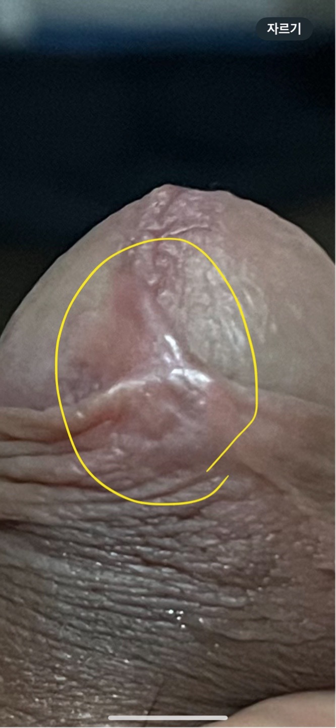 4번 째 사진