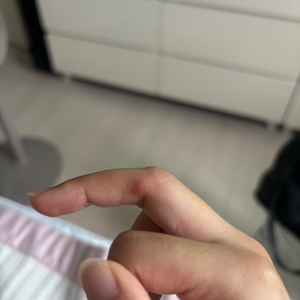 2번 째 사진