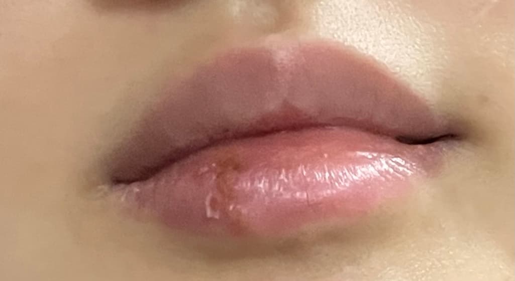 2번 째 사진